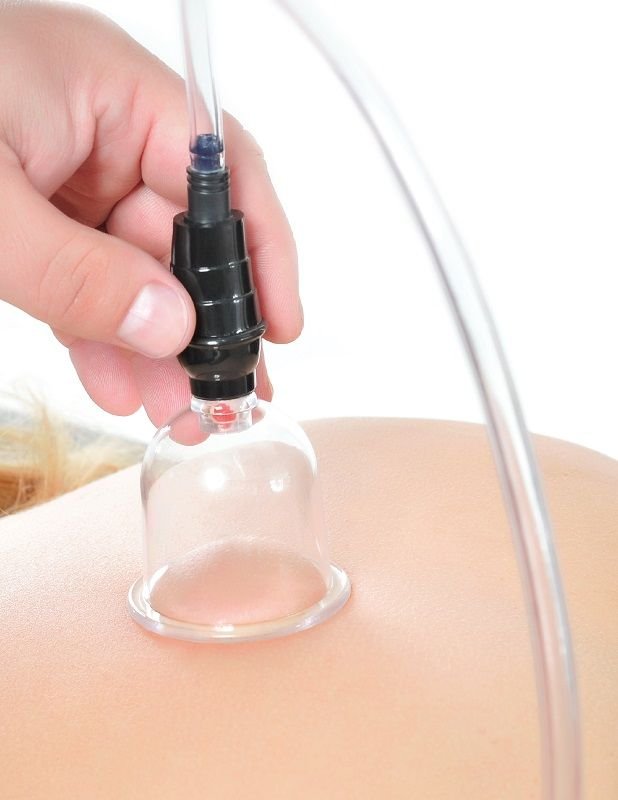 FETISH FANTASY SERIES - 6 PIECE SUCTION SET - Amore24